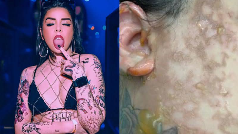 Superação! DJ Juliana Maddeira fala sobre grave acidente gravíssimo que queimou 10% de seu corpo - Divulgação