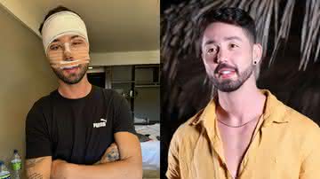 Rico Melquiades passa por procedimentos estéticos após pressão: "Não aguentava mais me chamarem de feio" - Instagram