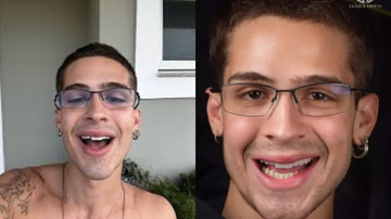 João Guilherme com lentes dentais naturais - Reprodução/Instagram/@drviotto