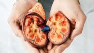 O cálculo renal pode causar dor intensa e desconforto (Imagem:  Peakstock | Shutterstock)