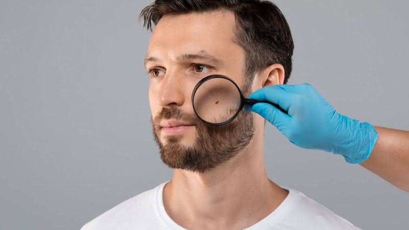 Pintas podem representar problemas de saúde (Imagem: Prostock-studio | Shutterstock)