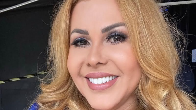 Joelma recebe diagnóstico após rosto inchado e adiamento de shows - Instagram