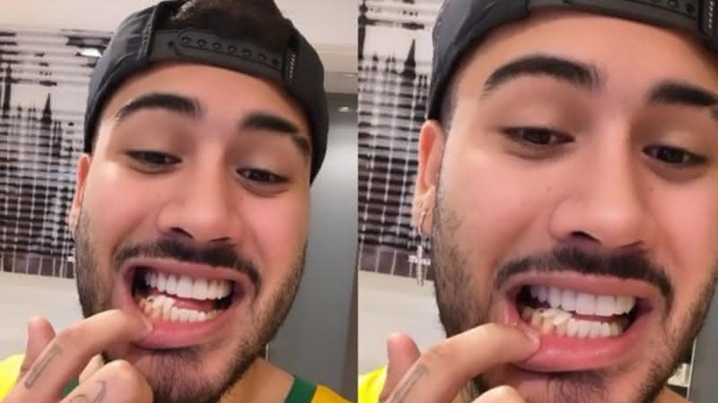 Kevinho quebra lentes provisórias dos dentes - Reprodução/ Instagram