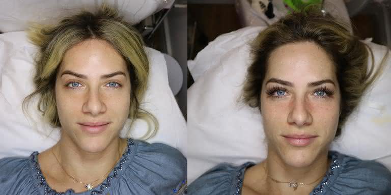 Antes e depois - Foto Divulgação