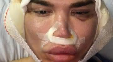 Rodrigo Alves - Reprodução/Instagram