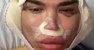 Rodrigo Alves - Reprodução/Instagram