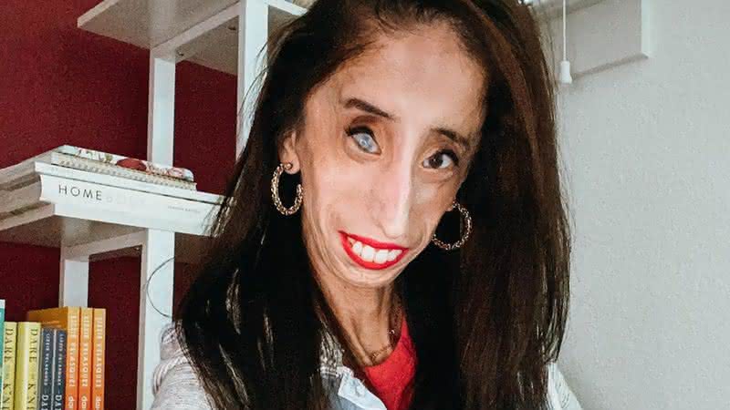 Lizzie Velasquez, autora motivacional, é alvo de ataques que zombam da aparência de pessoas com deficiência e faz apelo inspirador - Reprodução/ Instagram