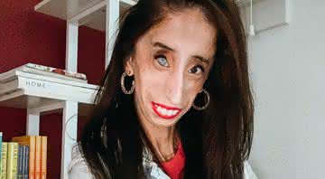 Lizzie Velasquez, autora motivacional, é alvo de ataques que zombam da aparência de pessoas com deficiência e faz apelo inspirador - Reprodução/ Instagram