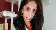 Lizzie Velasquez, autora motivacional, é alvo de ataques que zombam da aparência de pessoas com deficiência e faz apelo inspirador - Reprodução/ Instagram