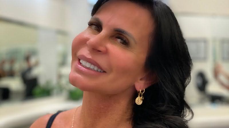 Gretchen compartilha resultado de novo procedimento estético e deixa fãs curiosos - Instagram