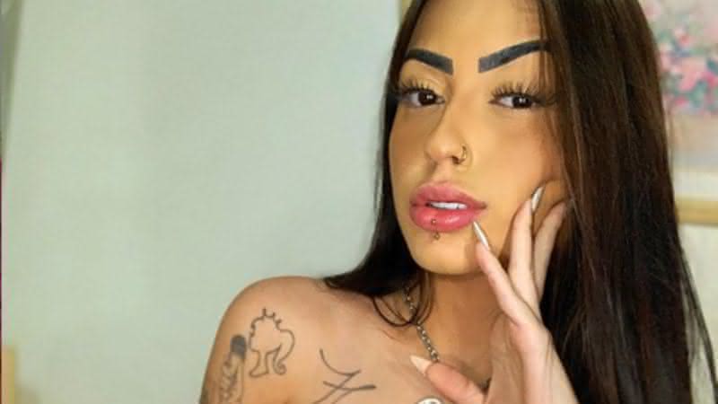 Mc Mirella compartilhou antes e depois de rinoplastia - Instagram