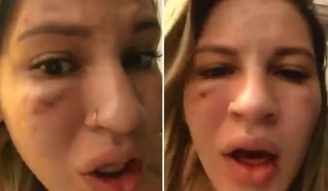 Milena Bemfica revela ter sofrido agressão do marido - Instagram