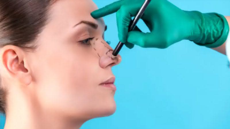 Rinoplastia preservadora, técnica cirurgica menos invasiva - Reprodução