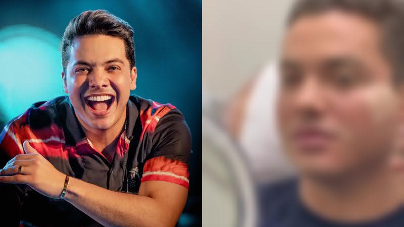 O cantor Wesley Safadão fez harmonização facial em uma clínica de estética - Reprodução/ Instagram