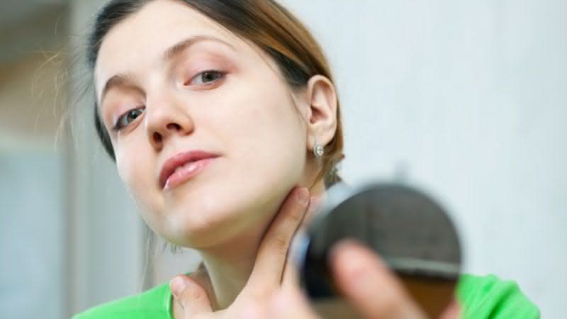 Melasma: saiba quais os cuidados essenciais para a prevenção das manchas - Instagram