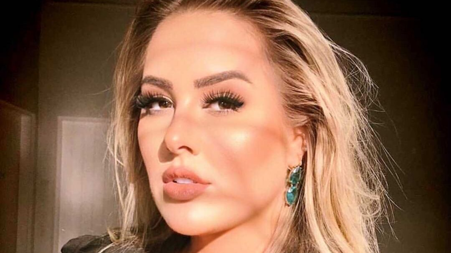 Patrícia Leitte passa por mais um procedimento estético: “Iniciei 2021 com mais um”