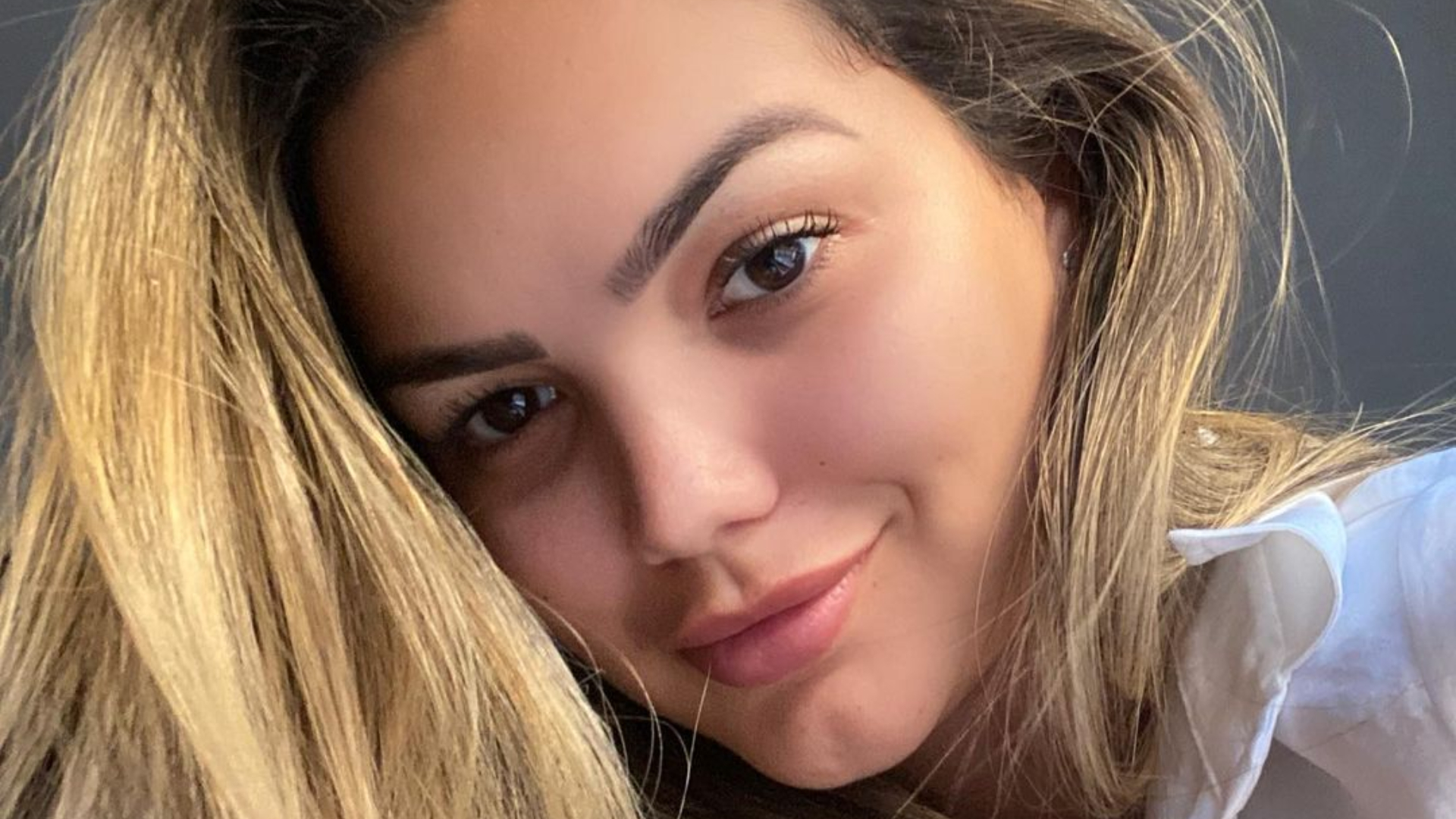 Filha de Kelly Key, Suzanna Freitas revela dificuldades em sua recuperação após cirurgia de mastopexia