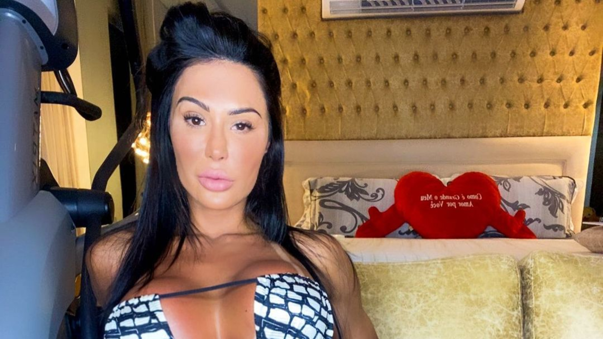 Gracyanne Barbosa revela problema na coluna: “Não fiquem iguais a mim”
