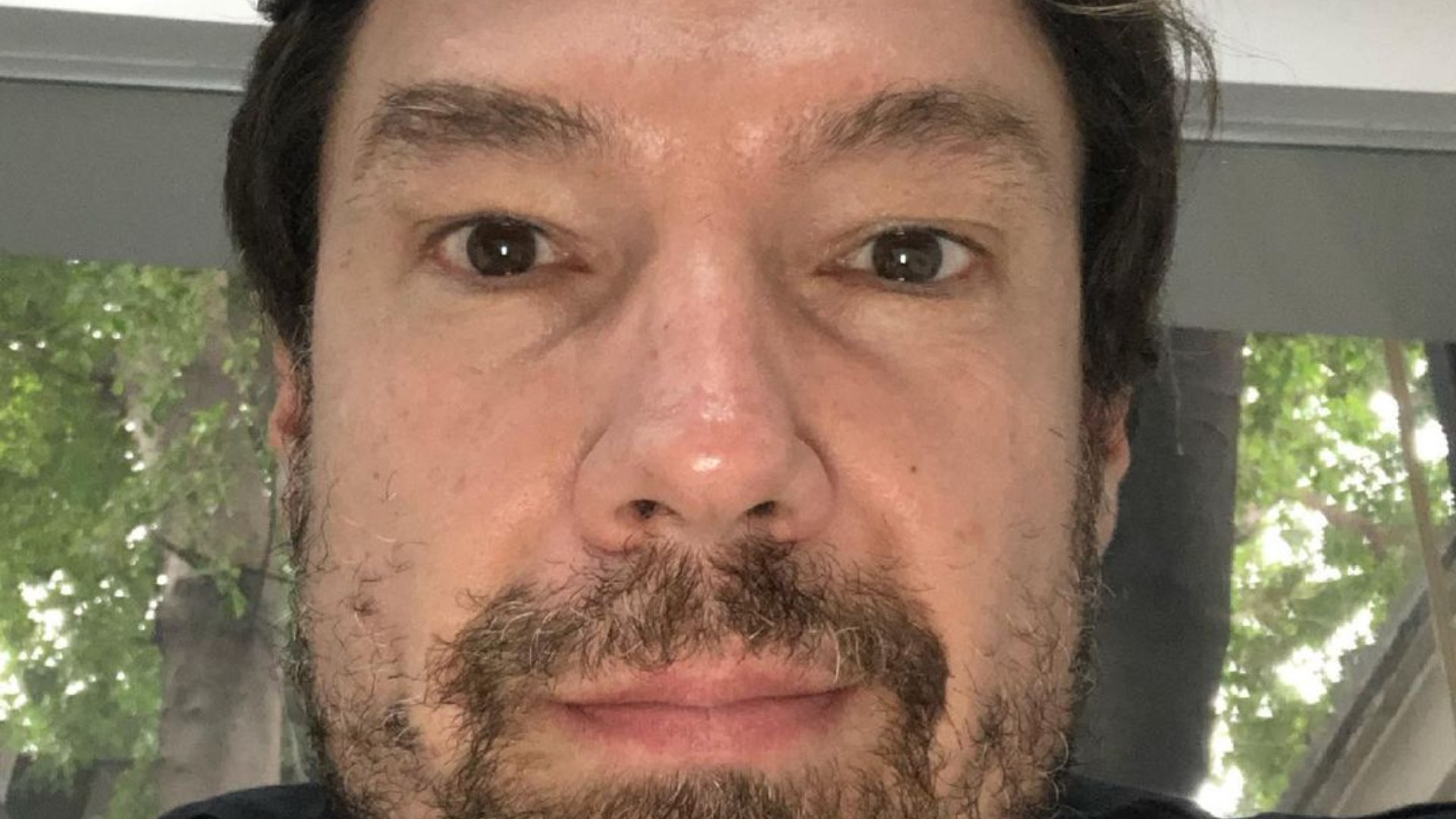 Lembra dele? Ricardo Macchi surge ensanguentado e causa polêmica