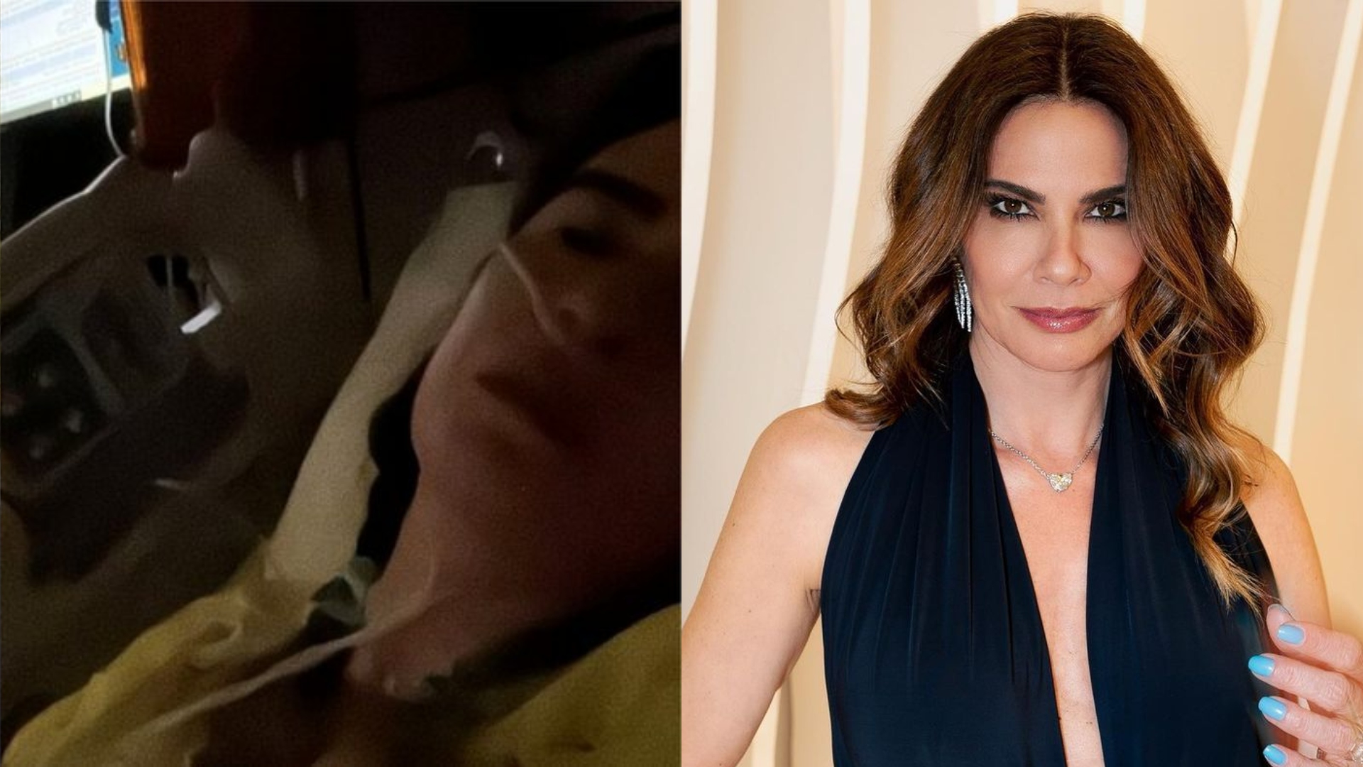 Luciana Gimenez sofre acidente gravíssimo e passa por cirurgia de emergência