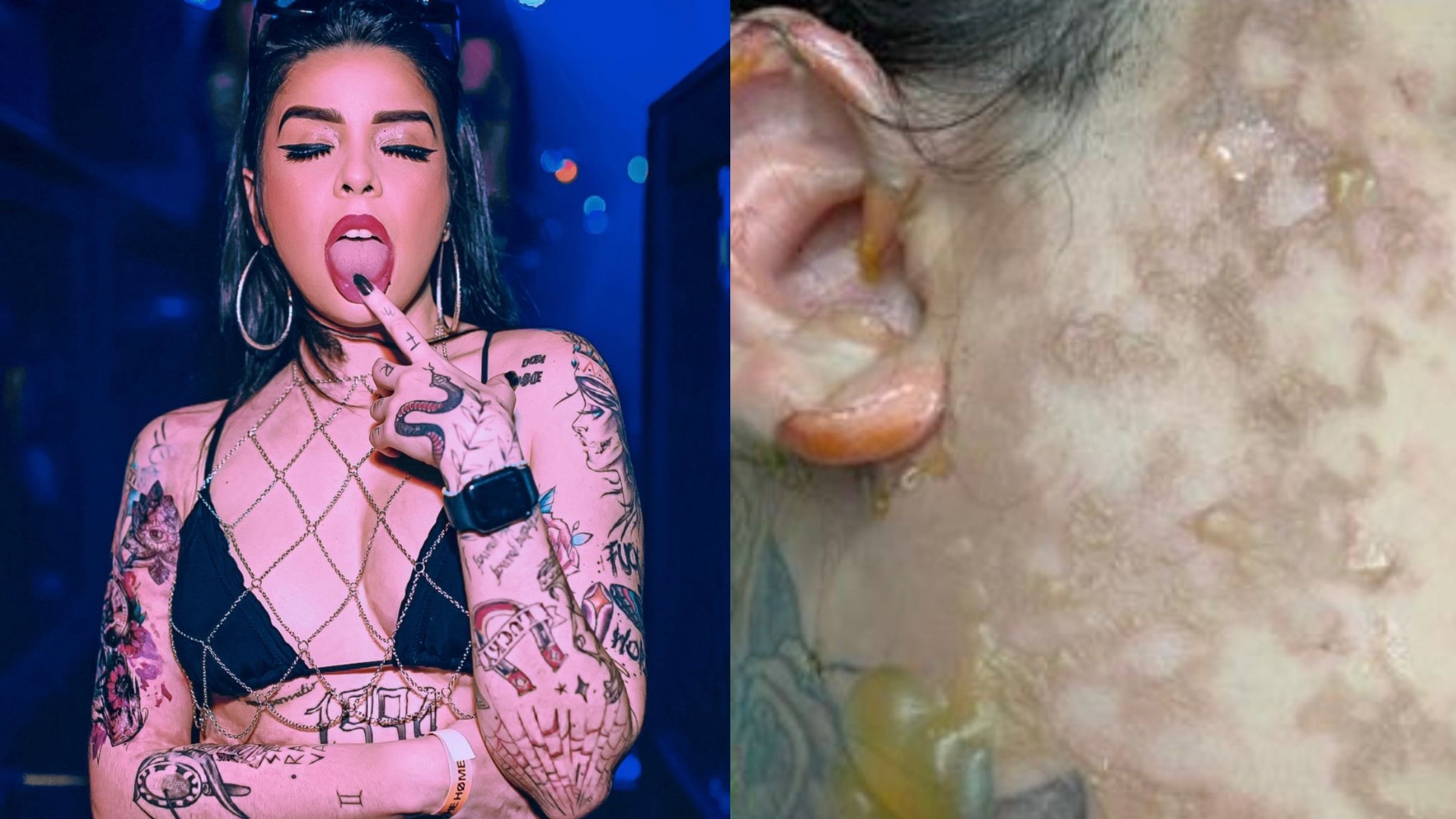 Superação! DJ Juliana Maddeira fala sobre grave acidente gravíssimo que queimou 10% de seu corpo