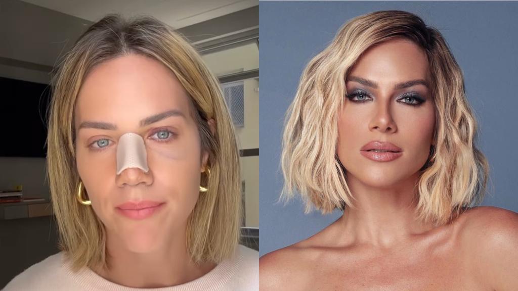 Giovanna Ewbank surge na web após cirurgia no nariz: “Precisava fazer”