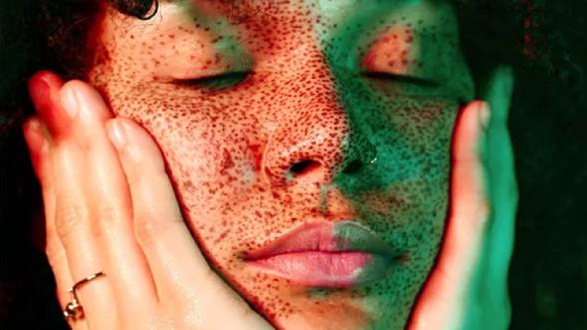 Ácido Tranexâmico: Conheça o novo queridinho da skincare