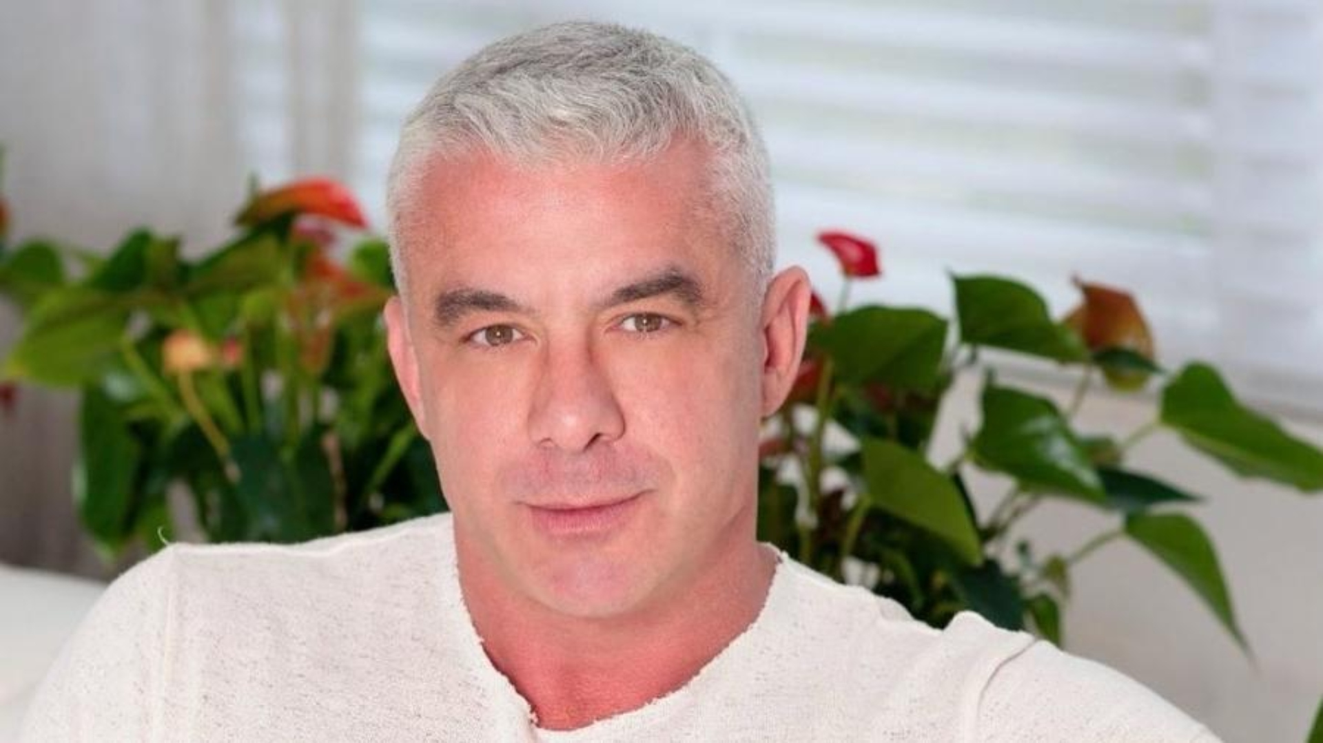 Alexandre Correa, marido de Ana Hickmann, exibe hematomas: “Marcas da quimioterapia”
