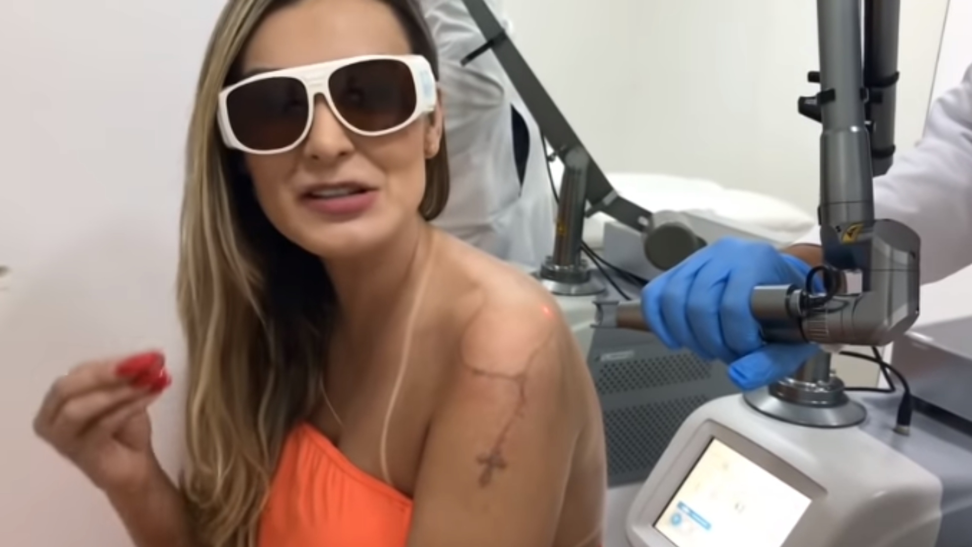 Andressa Urach filma procedimento no bumbum e apaga tatuagens: “Eu estou arrependida”