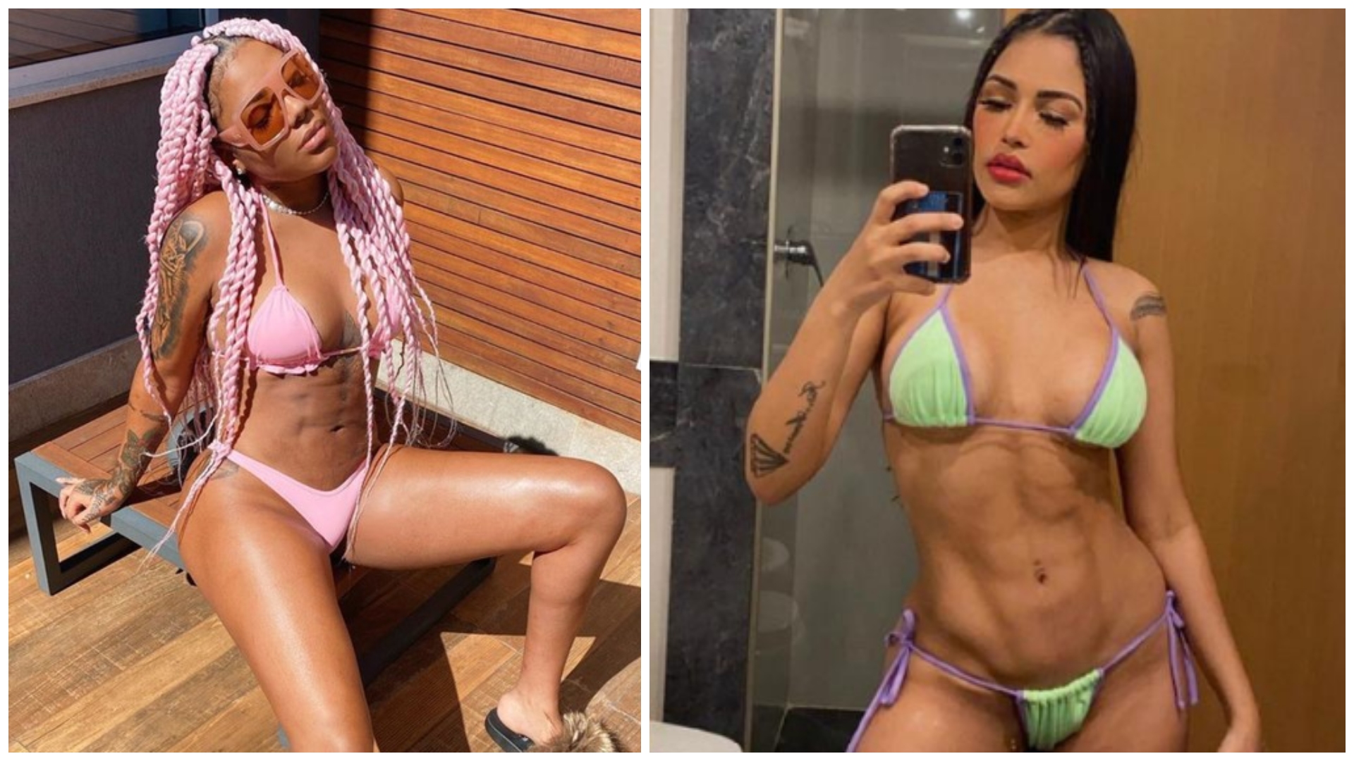 Afinal, o que exatamente é a Lipo Lad, cirurgia que ganhou o coração das famosas? Profissional explica!