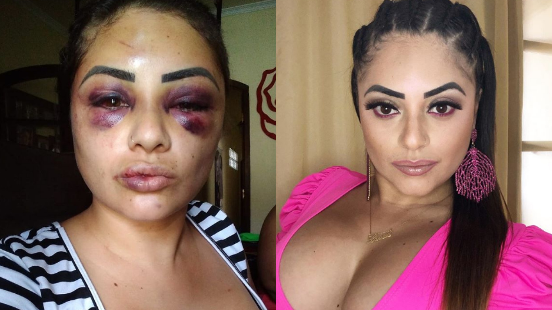 Influenciadora digital é agredida a pauladas e grava relato: “Tentaram furar meus olhos”