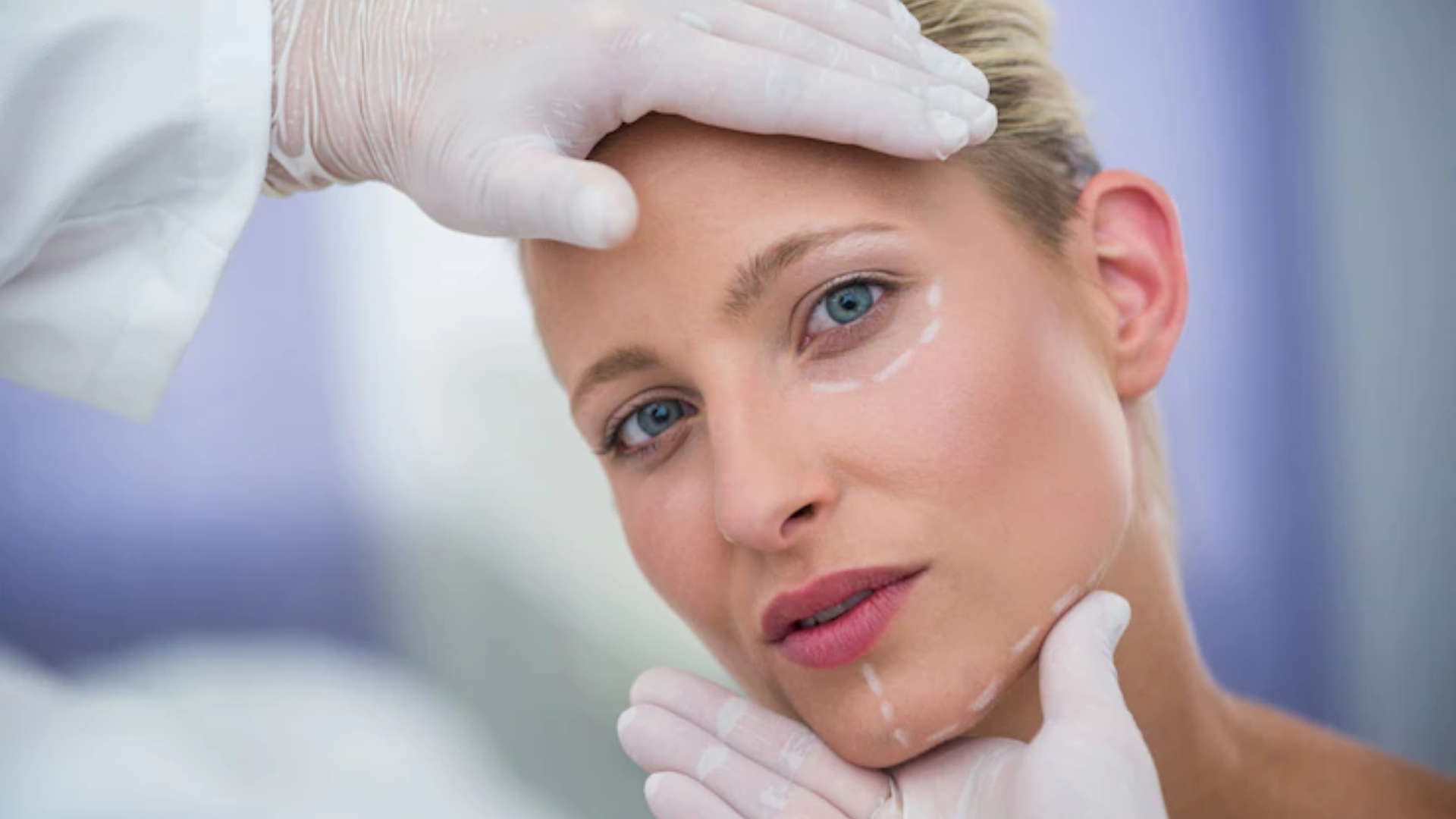 Especialista explica como funciona a reversão de harmonização facial mal sucedida
