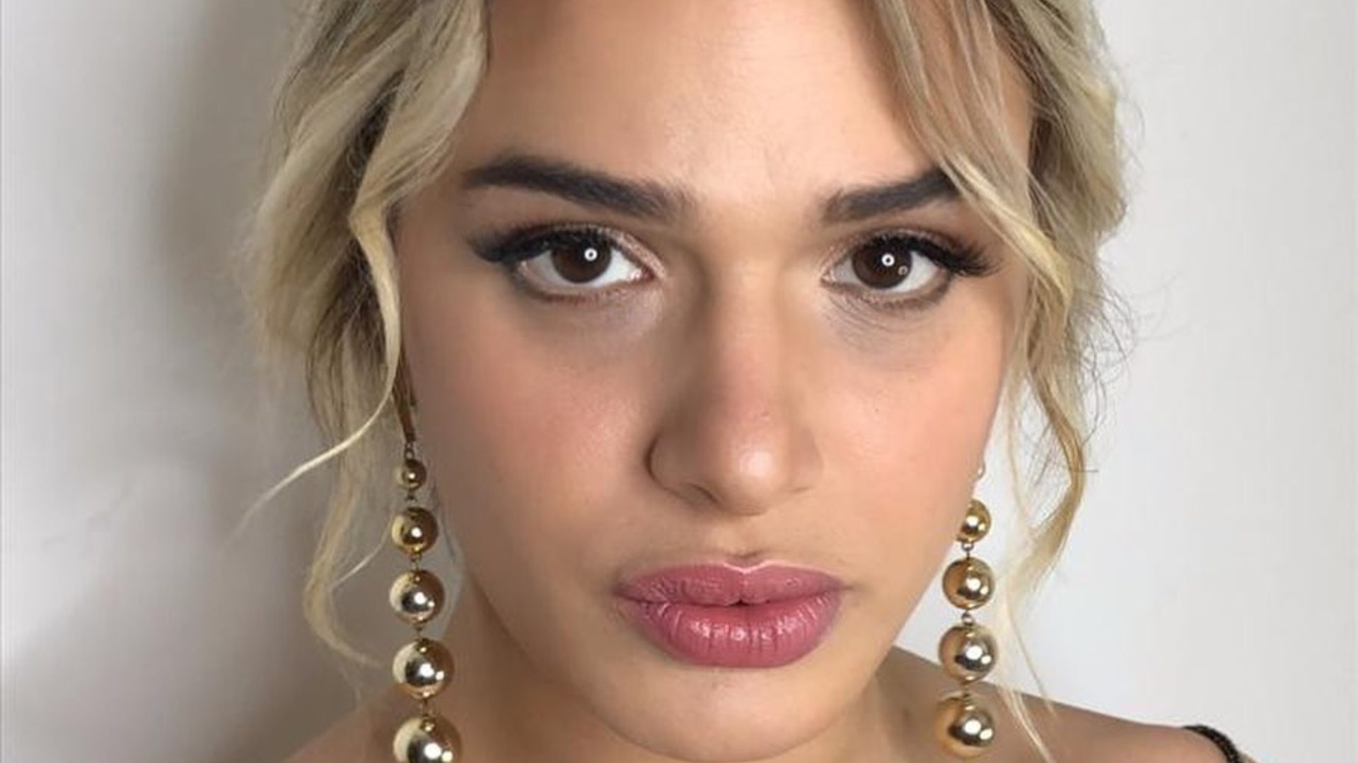 Glamour Garcia teve parte do dedo arrancado durante briga com o ex-marido