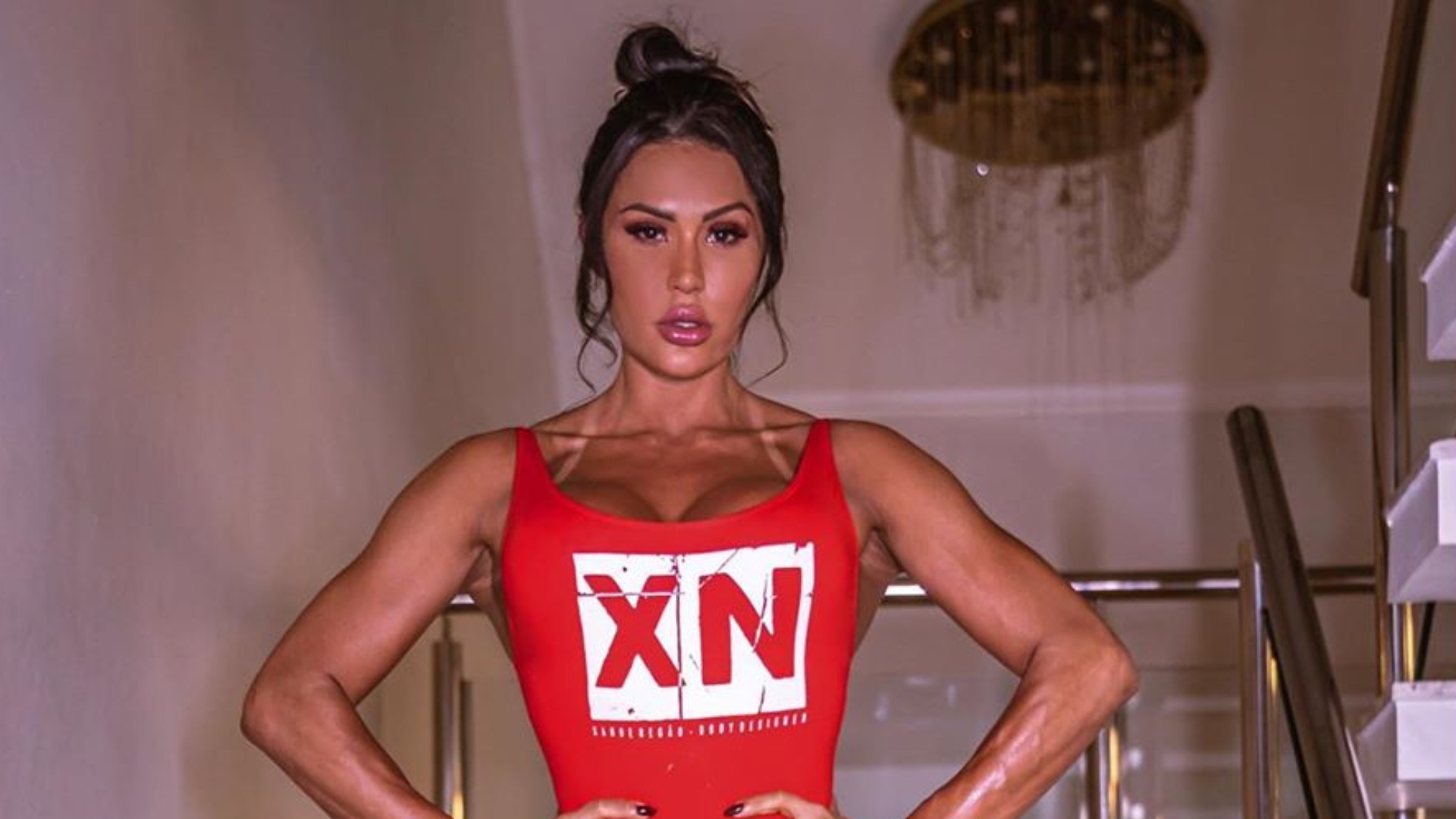 Gracyanne Barbosa mostra resultado de cirurgia no rosto e explica processo