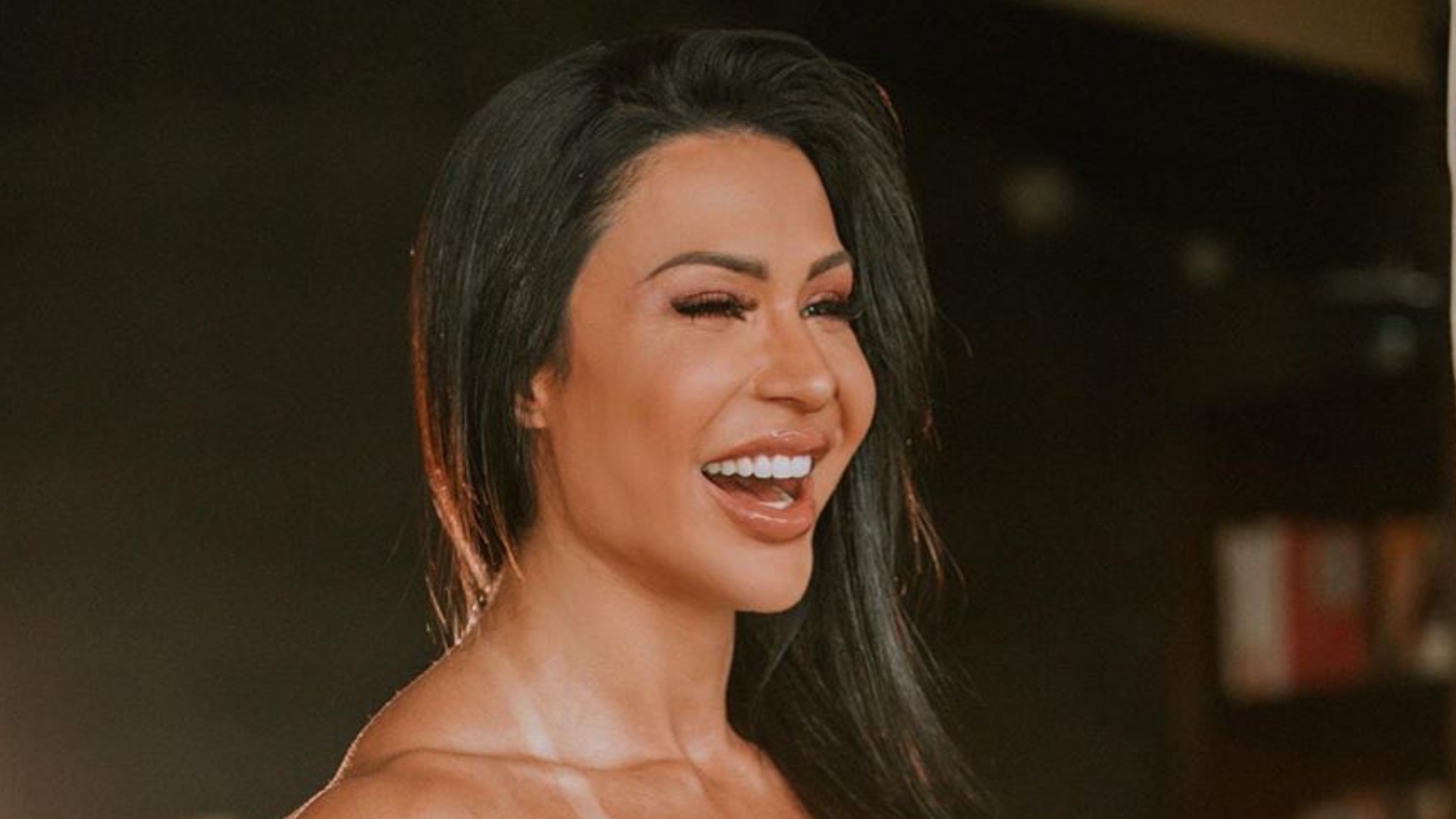 Gracyanne Barbosa mostra detalhes de procedimento estético para cuidar do bumbum