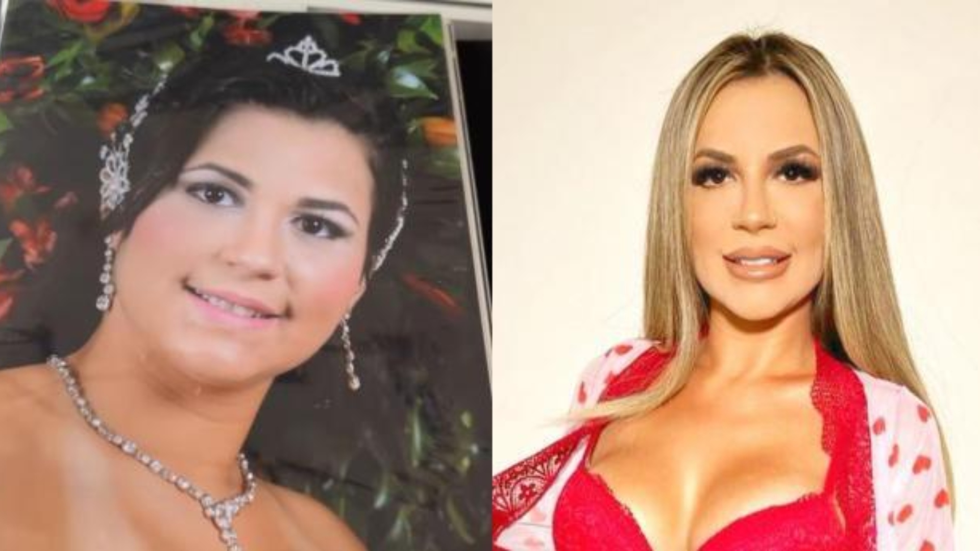 A Fazenda 14: Especialista conta quais são os procedimentos já feitos pelos participantes