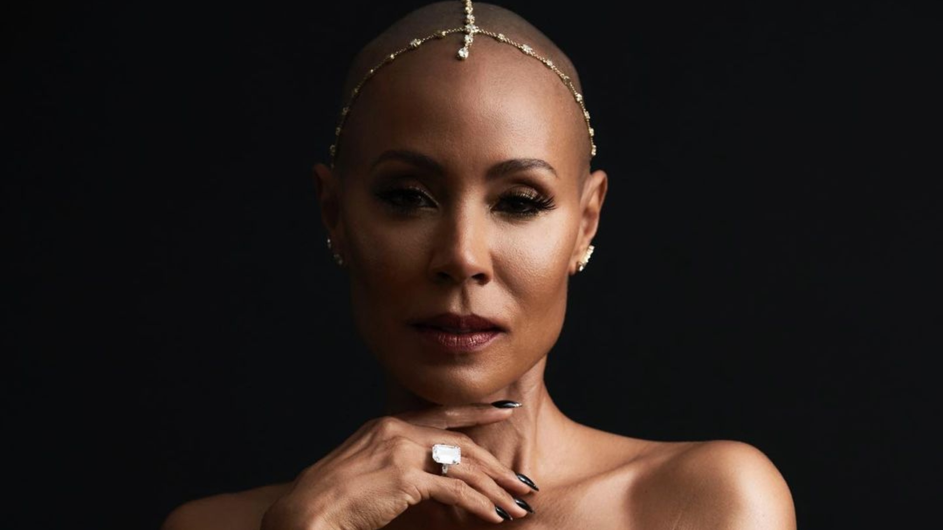 Saiba o que é alopecia, a doença de Jada Pinkett Smith que ganhou visibilidade no ‘Oscar 2022’