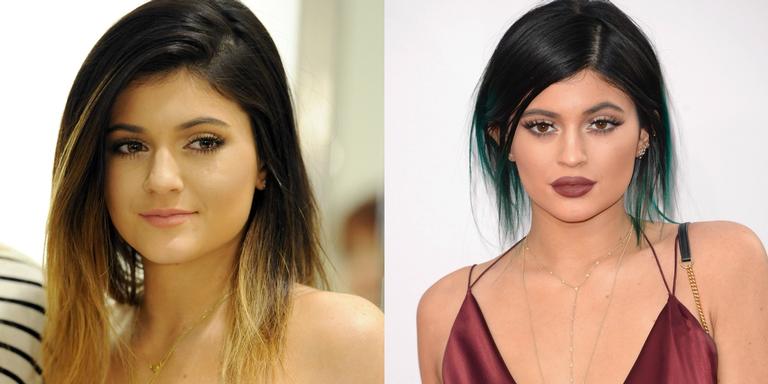 Bocão: o truque para conquistar os lábios de Kylie Jenner