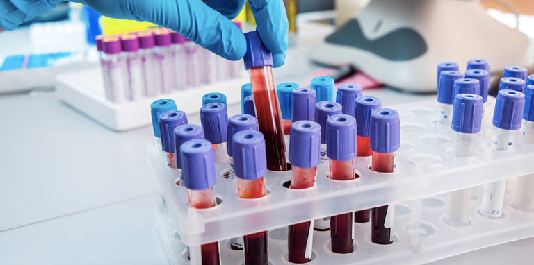 Proteção na veia: tipos de sangue que possuem menos chances de ter Alzheimer