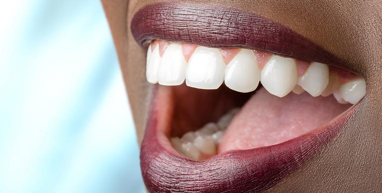 Saiba como tratar a sensibilidade nos dentes