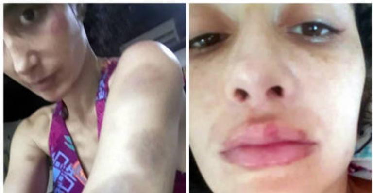 Após agressão de ex-diplomata, atriz vai lançar livro para ajudar mulheres vítima de violência doméstica