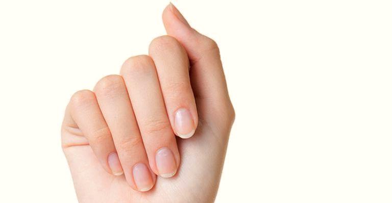 Unhas amareladas podem ser sinal de doença? Saiba o que fazer