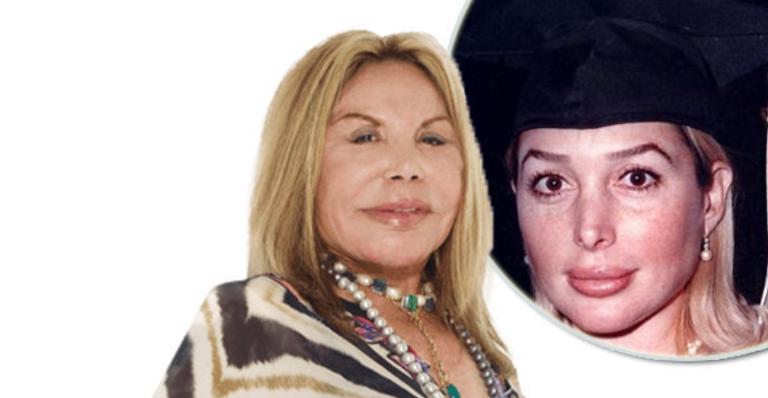Elsa Patton morre aos 84 anos após contrair doença não divulgada