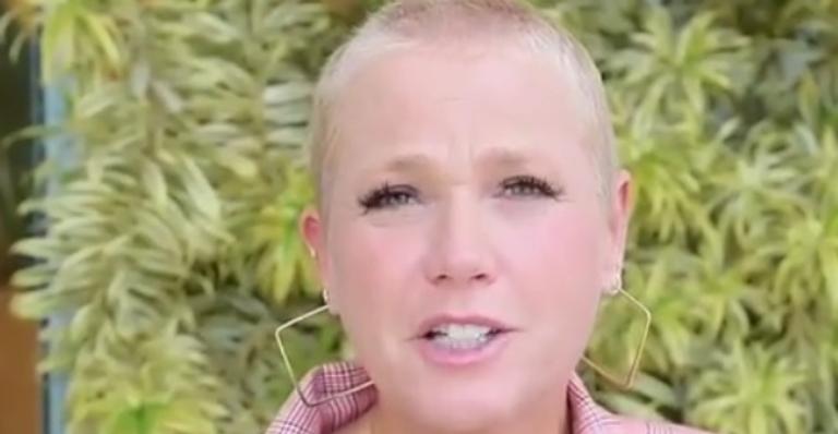 Xuxa detona ex-paquita após procedimento estético: ”Sem expressão”