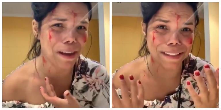 Day McCarthy leva golpe de martelo na cabeça e chora ao dizer que é vítima de perseguição