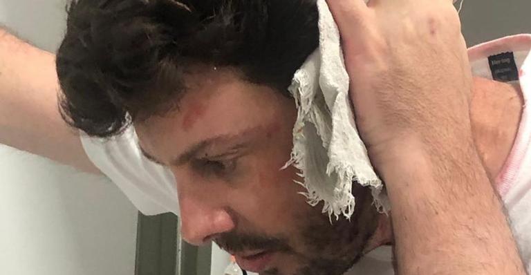 Caso de agressão em Danilo Gentili é explicado em comunicado oficial: ”Brincadeira combinada”