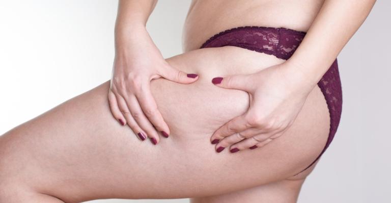 6 produtos que vão te ajudar a acabar com a celulite