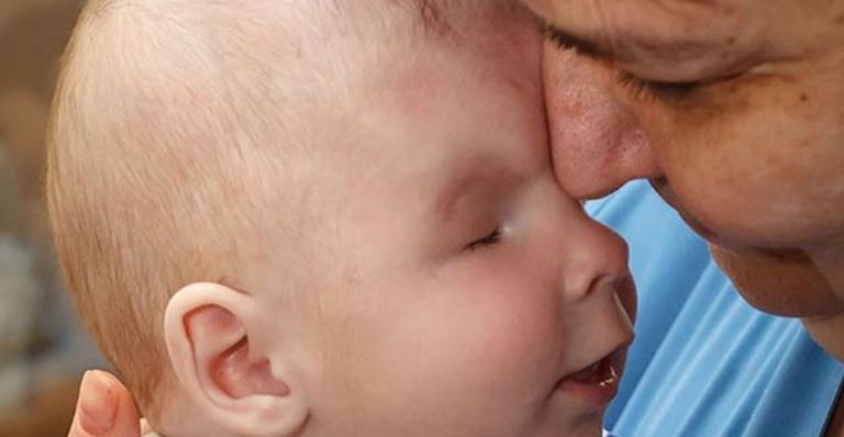 Bebê nasce sem os dois olhos e mãe resolve entregar para adoção