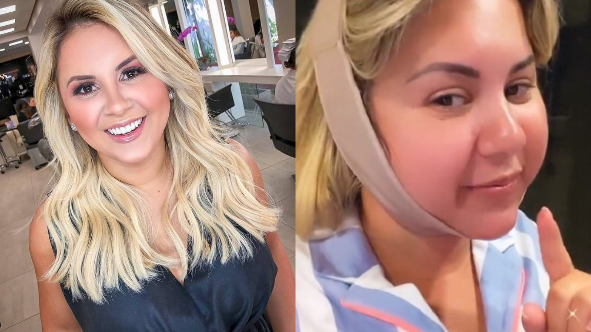 Natália Toscano passa por cirurgia corretiva e comenta sobre pressão estética: “Temos que nos sentir bem e felizes”