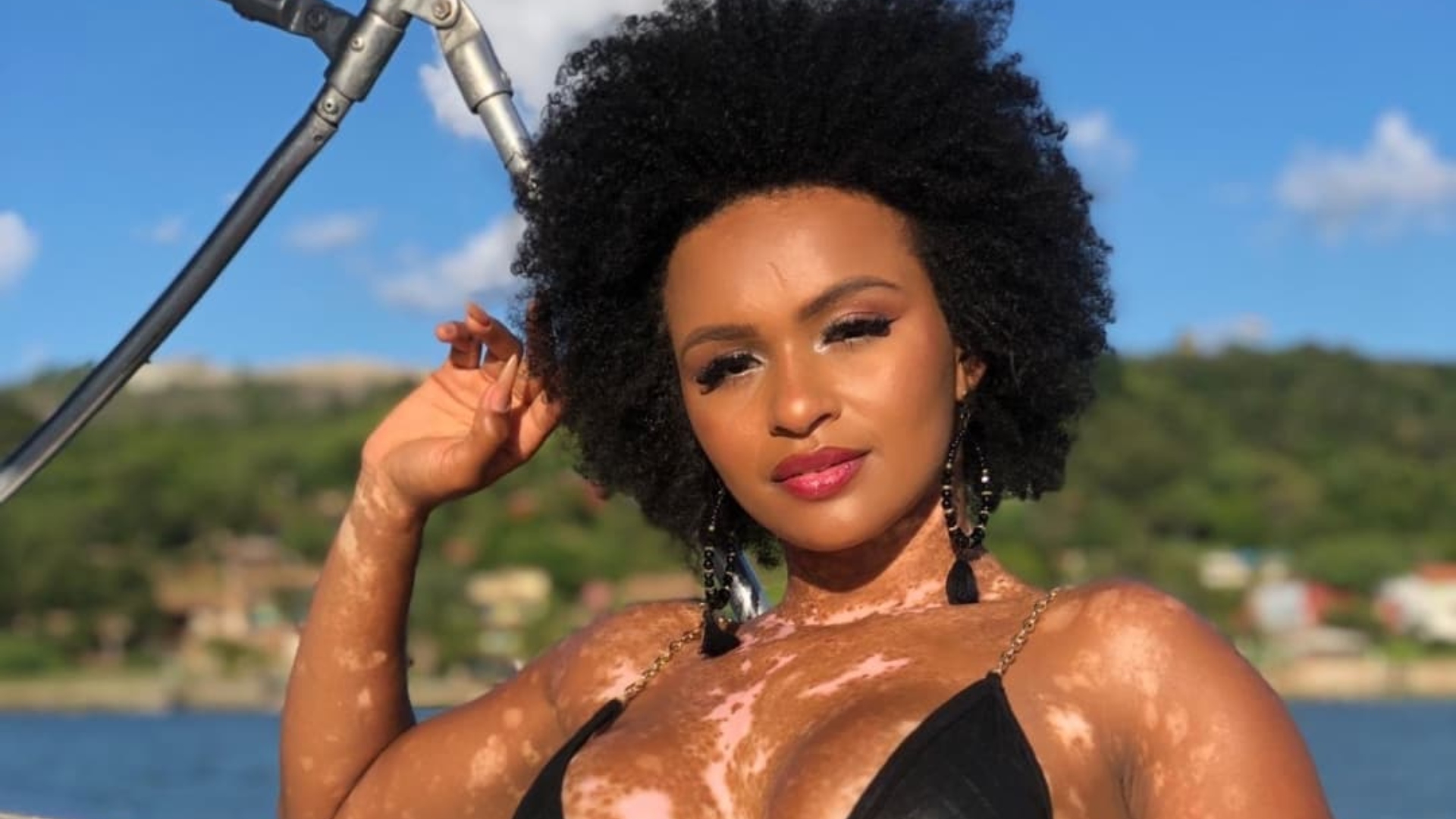 Vitiligo, melasma e rosácea: Roseli Siqueira ensina como deve ser feita a rotina de skincare para quem sofre com essas condições